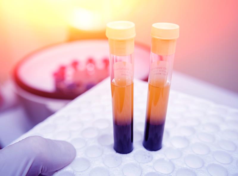 PRP Therapy